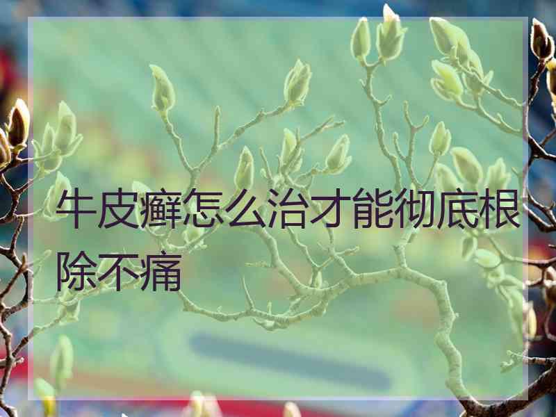 牛皮癣怎么治才能彻底根除不痛